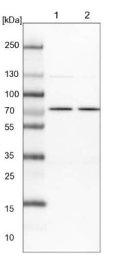 PDE11A Antibody, Novus Biologicals 0.1mL; Unlabeled:Antibodies, Polyclonal